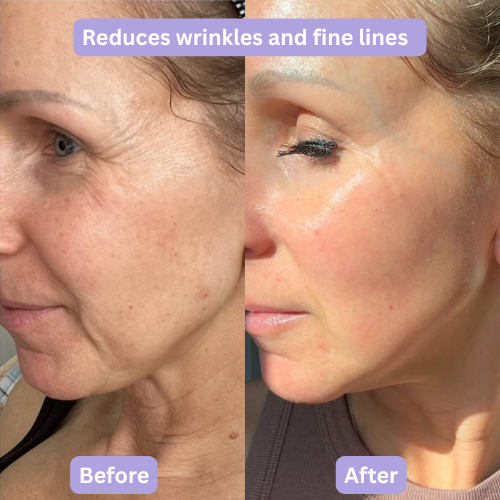 Hydrolyzed Collagen Peptide