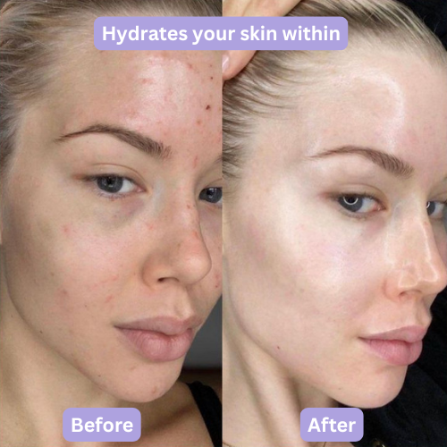 Hydrolyzed Collagen Peptide
